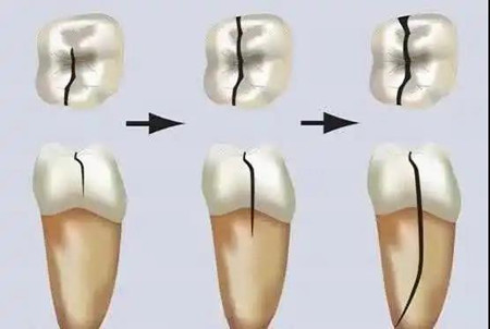 别小瞧牙齿的敏感反应，应对方法来了