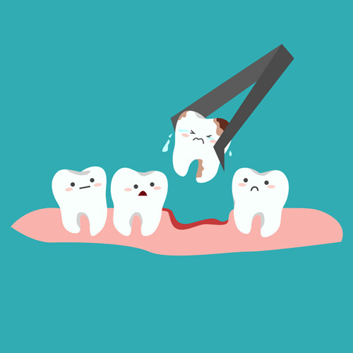 50%的矫正患者要拔牙？真相是……