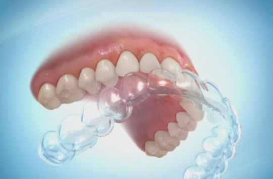 006QRL96gy1gsdf43tdstj60f109v3z402.jpg 006QRL96gy1gsdf43tdstj60f109v3z402.jpg