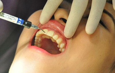 src=http___www.lovelytooth.com_uploads_allimg_170119_4-1F119141539362.jpg&refer=http___www.lovelytooth_副本.jpg src=http___www.lovelytooth.com_uploads_allimg_170119_4-1F119141539362.jpg&refer=http___www.lovelytooth_副本.jpg